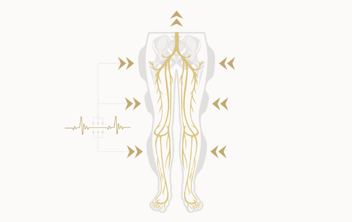 A diagram of a retrograde aortic pressure wave moving from the calves toward the lower hips.